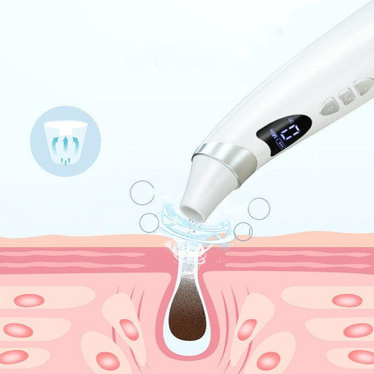 Electric Visual Blackhead Suction Instrument Household Cleansing Pore Cleaner For Skin Equipment Skin Care Tool - Beauty Lifts Her